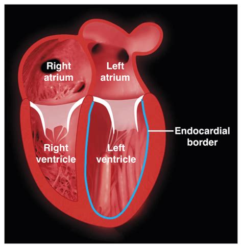 lv systolic function 意味|impaired lv systolic function meaning.